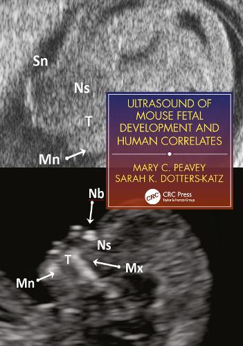 Ultrasound of Mouse Fetal Development and Human Correlates.