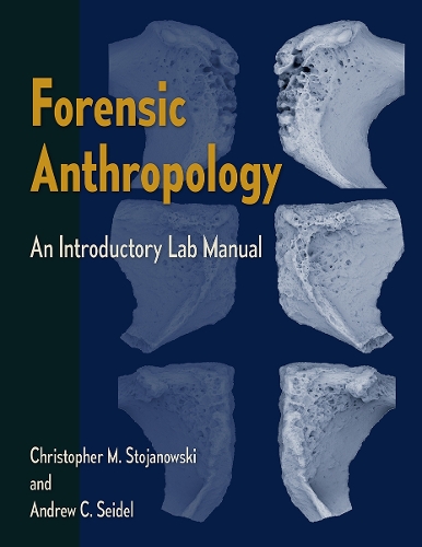 Forensic Anthropology: An Introductory Lab Manual.