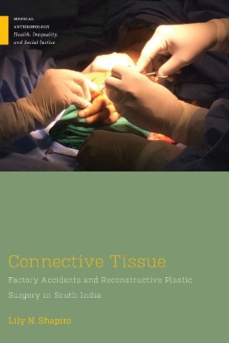 Connective Tissue: Factory Accidents and Reconstructive Plastic Surgery in South India.