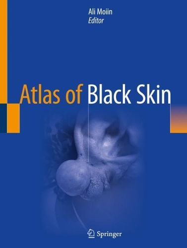 Atlas of Black Skin. 1st ed. 2020