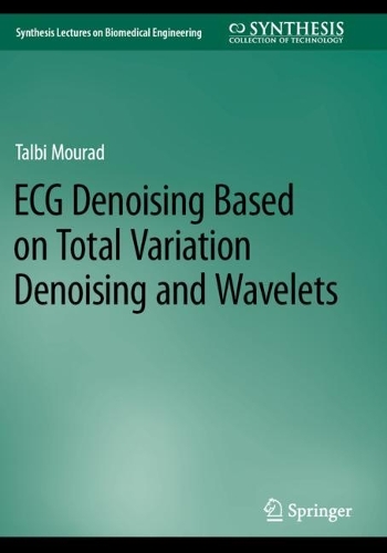 ECG Denoising Based on Total Variation Denoising and Wavelets. 2023 ed.