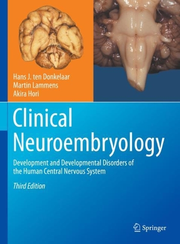 Clinical Neuroembryology: Development and Developmental Disorders of the Human Central Nervous System. Third Edition 2023