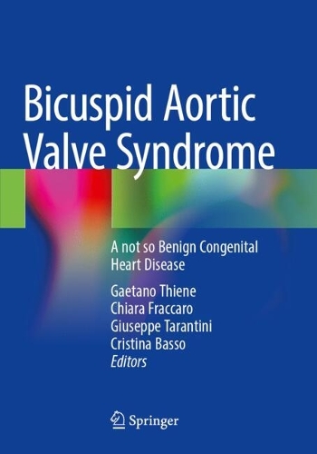 Bicuspid Aortic Valve Syndrome: A not so Benign Congenital Heart Disease.