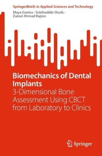 Biomechanics of Dental Implants: 3-Dimensional Bone Assessment Using CBCT from Laboratory to Clinics.